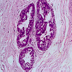 Coupe transversale d'un canal mammaire vu sous microscope